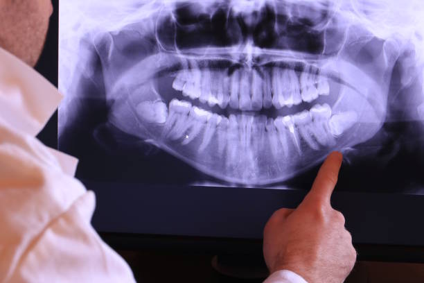 Best Broken or Cracked Tooth Emergency Dentist in Durant, IA